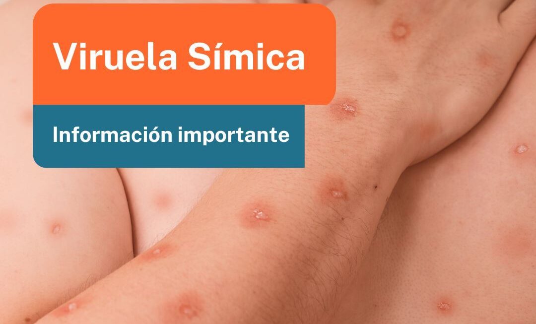 Salud llevó tranquilidad respecto de un posible caso sospechoso de viruela símica en Comodoro Rivadavia