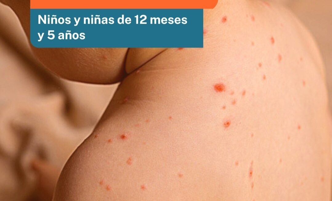 Chubut solicitó verificar y completar la vacunación de niños contra el Sarampión