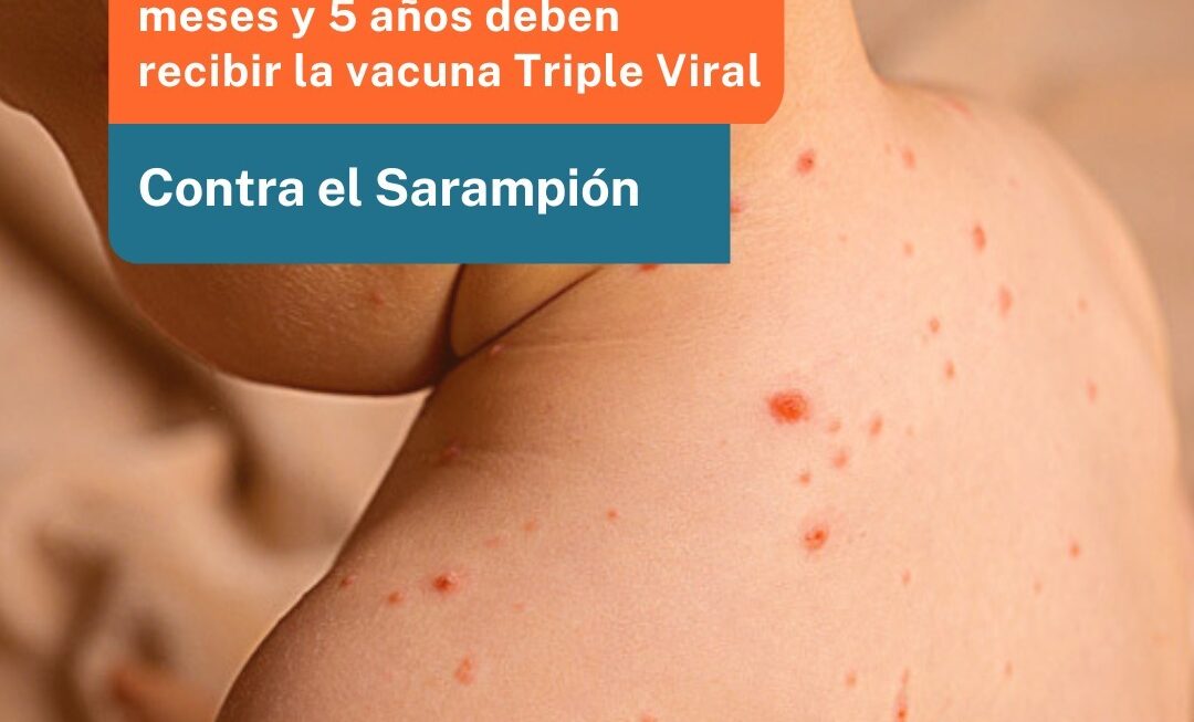Provincia pide verificar y completar vacunación de niños contra el Sarampión